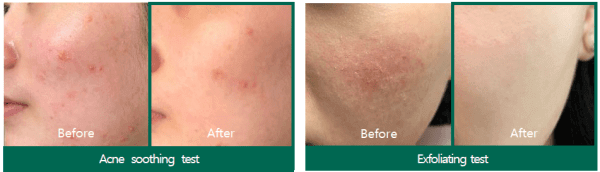 Some By MI AHA-BHA-PHA Miracle Acne Clear Foam - Auryn Skin - Italia